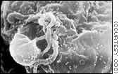 Le virus VIH